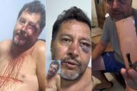 Assessor parlamentar denuncia sessão de espancamento durante ação da PM em Sabará