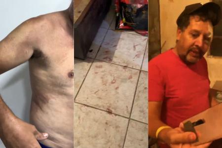 Assessor parlamentar teve ferimentos no rosto e no corpo • Imagens cedidas