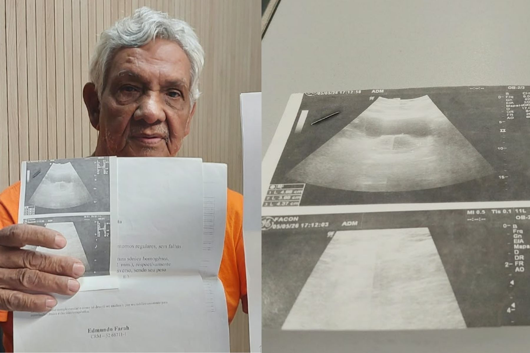 Idoso de 70 anos vem do Rio a BH para cirurgia de hérnia e faz apelo para reencontrar sobrinho