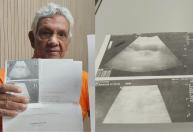 Idoso de 70 anos vem do Rio a BH para cirurgia de hérnia e faz apelo para reencontrar sobrinho