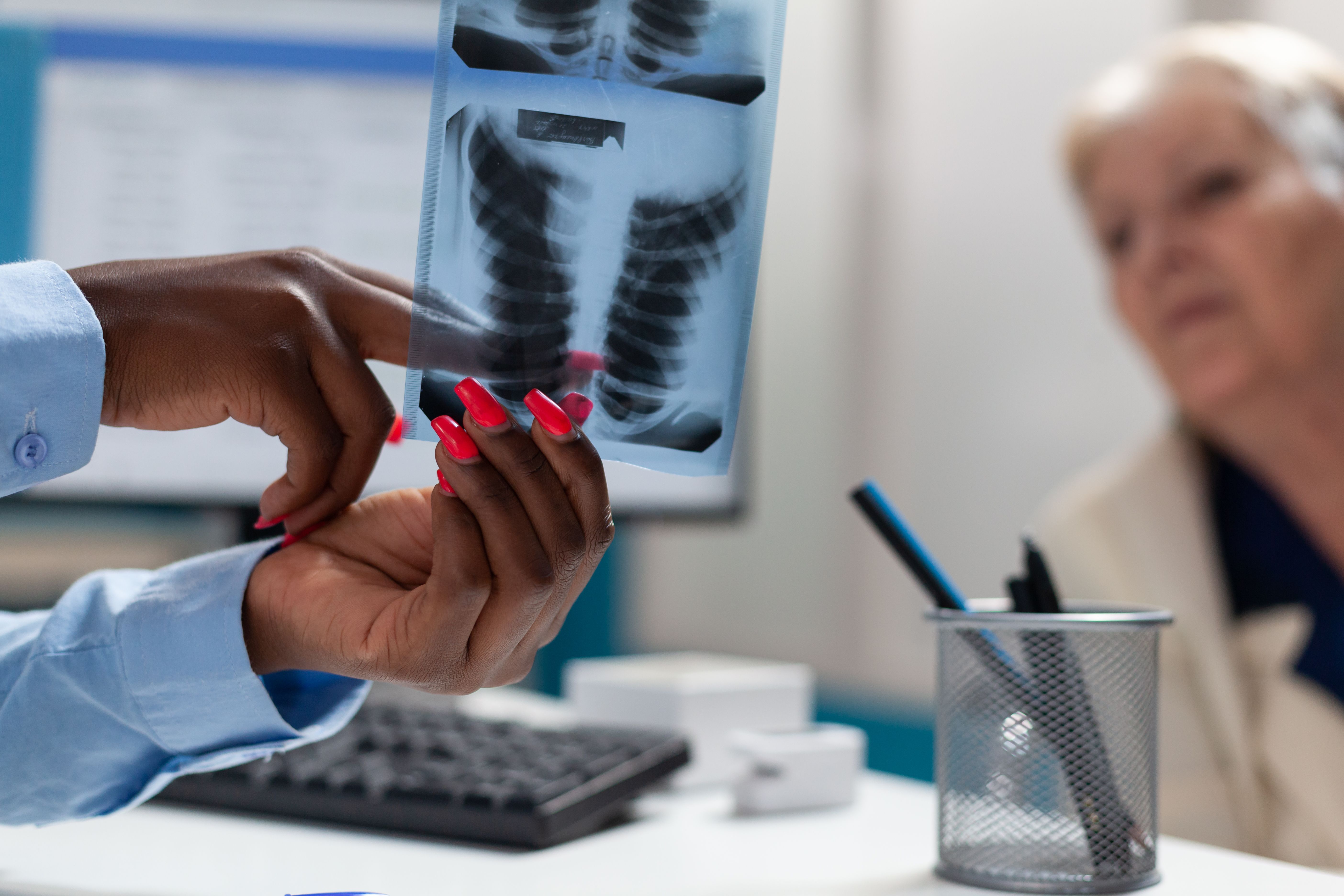 Câncer de pulmão: Anvisa aprova novo medicamento em casos metastáticos
