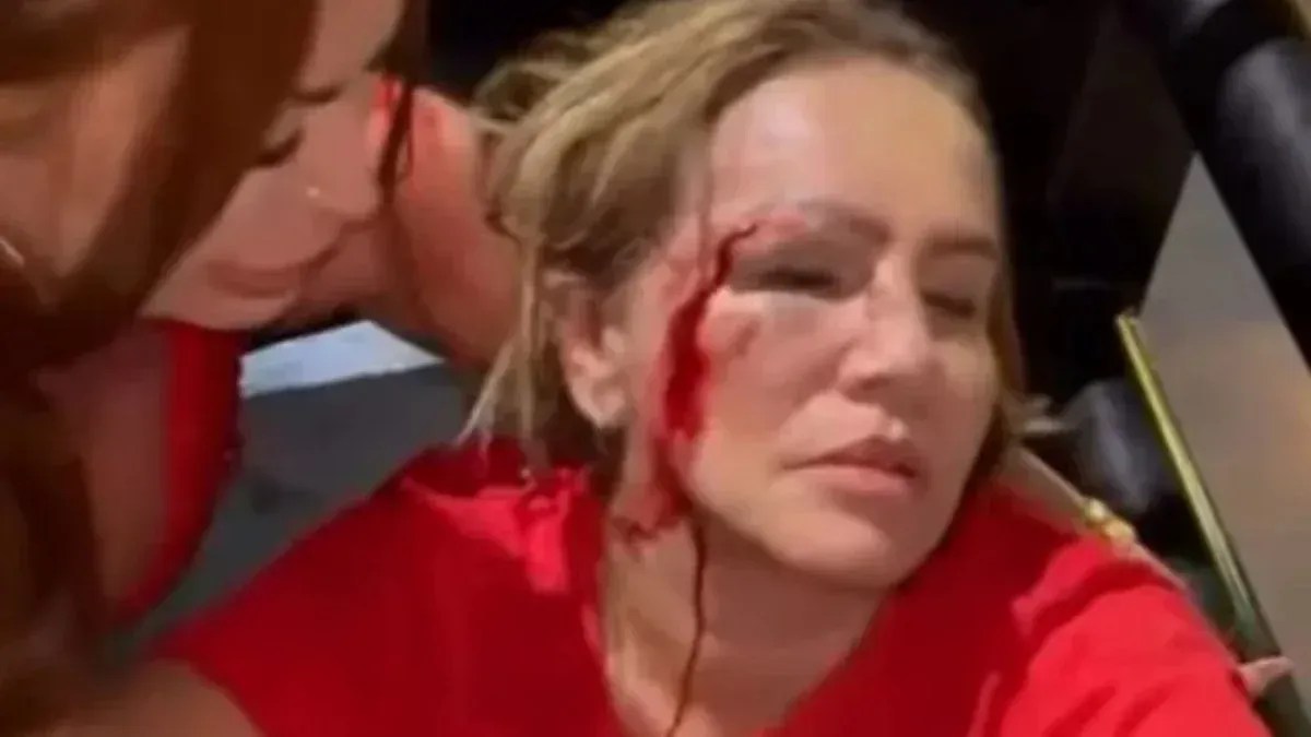 Vereadora do PT é atingida na cabeça durante ato de apoio a Lula em Montes Claros, no Norte de MG